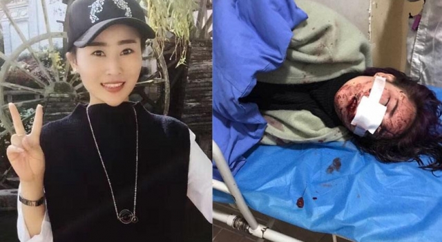 丽江"女游客遭暴打毁容"案 法院已受理