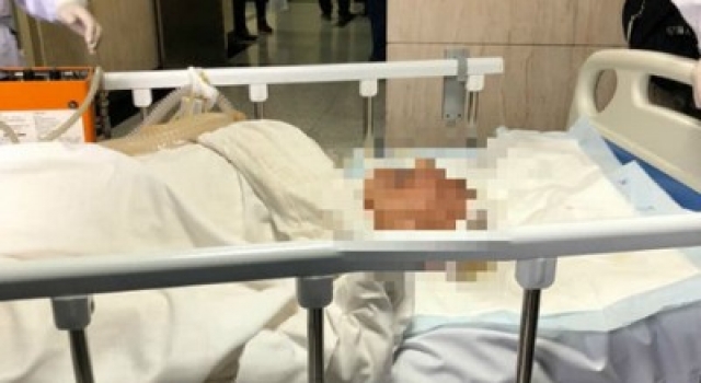 医学名人李谋秋在路上被外卖小哥撞倒,最后导致死亡