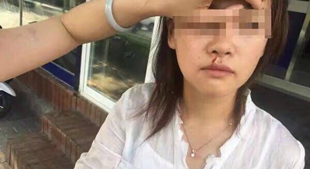 滴滴司机打伤乘客 究竟谁对谁错