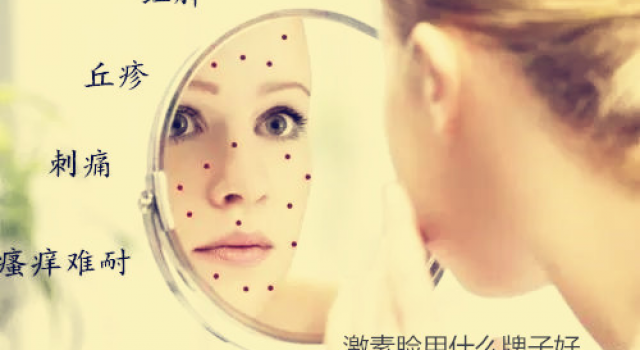 激素脸用哪款护肤品 那么激素脸可以用化妆品吗