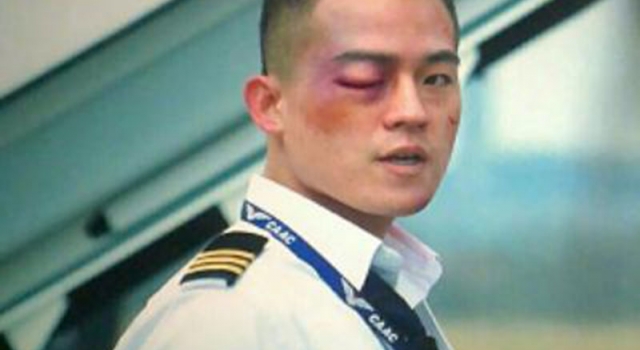 欧豪好惨上热搜 鼻青脸肿被刮下飞机 网友直呼太心疼