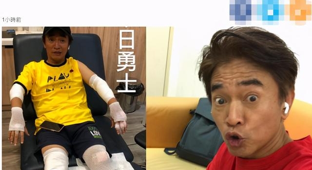 58岁吴宗宪录节目发生意外!头部受到严重撞击,手脚缠满纱布