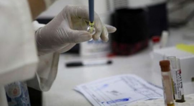 我国发现寨卡病毒：寨卡病毒究竟是何方妖孽？
