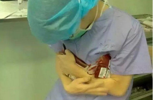 手术台上急需用血 医生怀捂4度血袋:求快点升温 救命呢