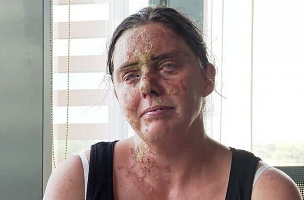 丧心病狂!英国俩兄弟向母亲泼硫酸 弟弟逃走击掌庆祝