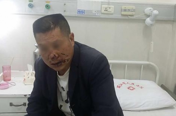 丽江古城"城管"酒后伤人 回应：打人者为合同工