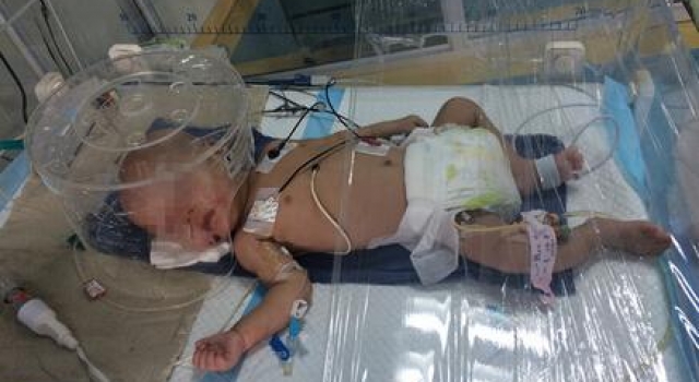 男婴肋骨骨折头颅出血疑遭虐待 父亲笑称摔过两三回