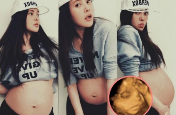 伊能静剖腹伤口复原中 网友加油打气