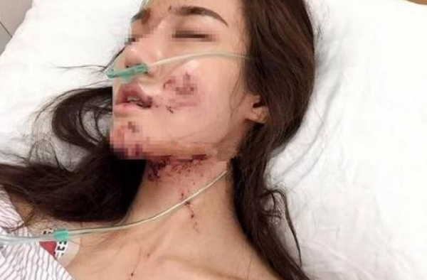 网红坐宝马遇车祸毁容 男子竟找替死鬼欲私了