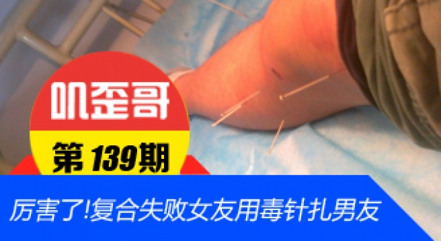 【叽歪哥 V0.139】一言不合就扎针！复合失败女友用毒针扎男友