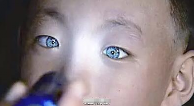 男童天生蓝色＂猫眼＂自带夜视功能 黑暗中能清晰写字