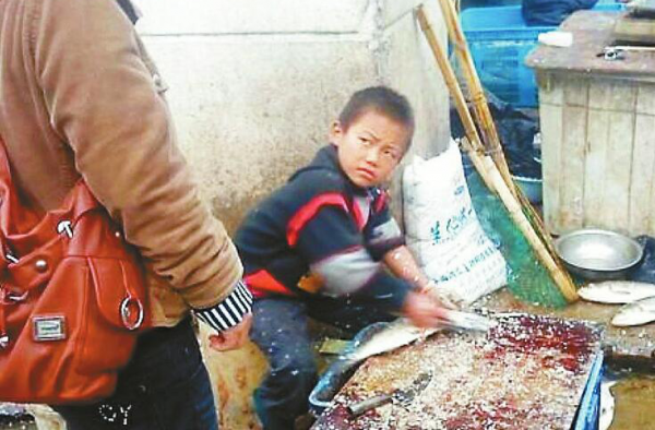 “杀鱼弟”饮百草枯自杀，肾脏损坏，已进入尿毒症期