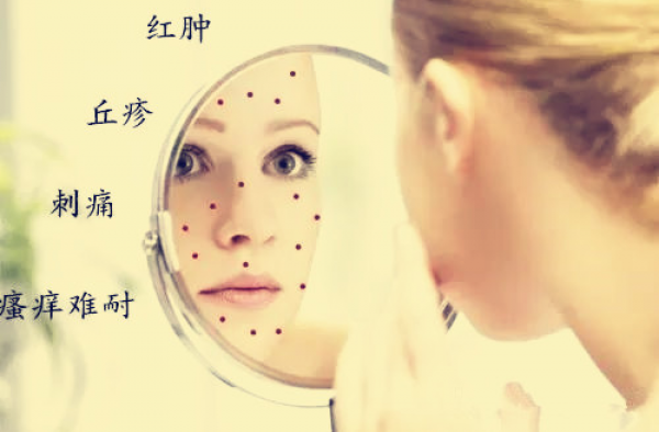 激素依赖性皮炎如何治疗？激素脸要怎么修复