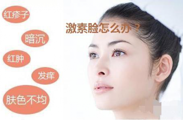 什么是激素脸？激素脸的症状怎么调理好