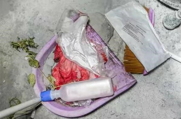泼酸割喉重伤妻儿   妻儿重伤男子家暴后上吊身亡