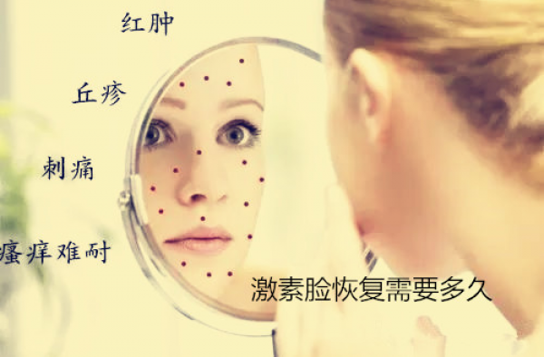 激素脸怎样才能修复？激素脸恢复需要多久