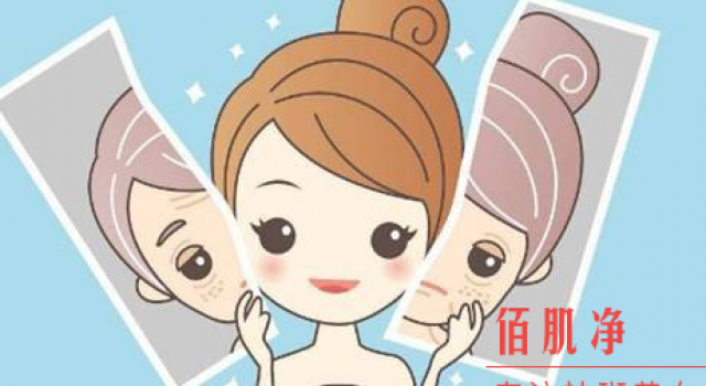 女人怎么有效去除黄褐斑?分享眼角长了黄褐斑怎么去除