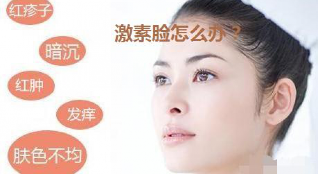 激素脸用什么能好？那么脸上长了很多激素脸怎么办