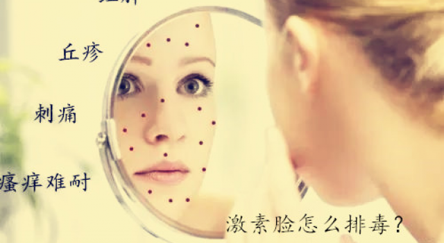 激素脸怎么排毒？为什么激素脸排毒过程中很痒