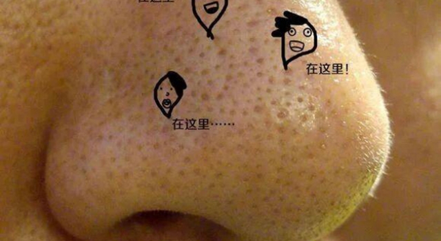 脸上出油很厉害该怎么办 注意这三点 再也没烦恼
