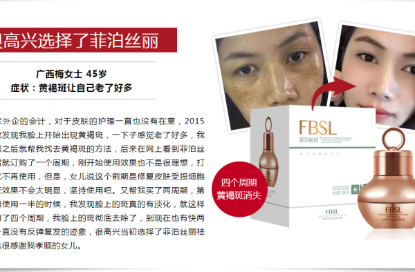 脸上的黄褐斑怎么去掉，去掉黄褐斑的人都用了这款产品！