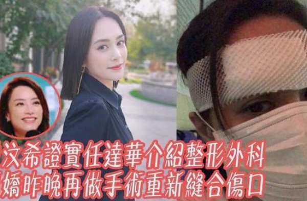 朱叔直言钟欣潼可怜，命运并未放过她，如今位列“缝针数”第一人