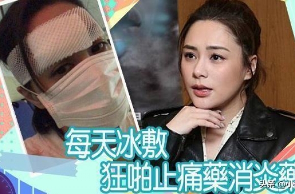 阿娇脸部受伤被缝66针，前夫却发微博晒大餐，昔日感情说散就散