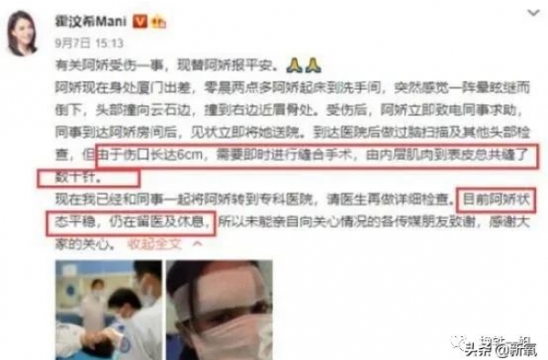 阿娇伤后光速复工，缝66针的脸部疤痕凭空消失？魔幻手法...