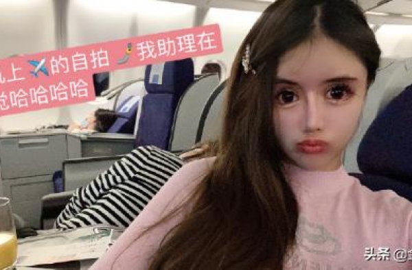 13岁开始整容的周楚娜公开相关细节：花费四百万，打上百针麻药