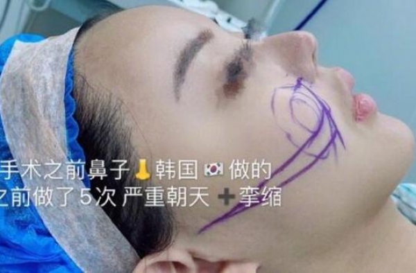 21岁韩安冉第35次整容整出木偶尖鼻，香港网友：再整要变僵尸