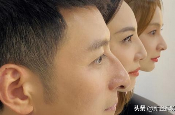 吴昕因鼻子被误认李维嘉妹妹，郑希怡又来认亲？鹰钩鼻成明星标配