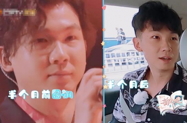 90后男歌手自曝整容经历！打瘦脸针导致面瘫，至今仍有心理阴影
