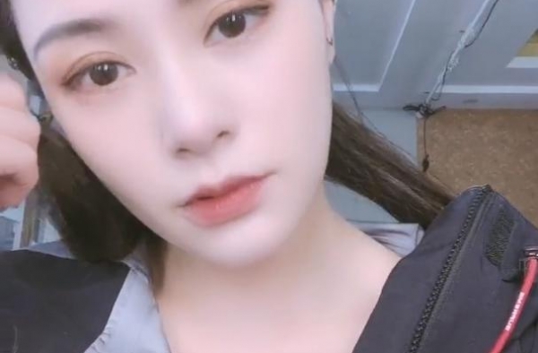 阿娇受伤化完妆之后开最强美颜几乎看不见 发文感谢你曾来过