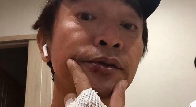 吴宗宪骑车四肢摔伤，要做脑部检查