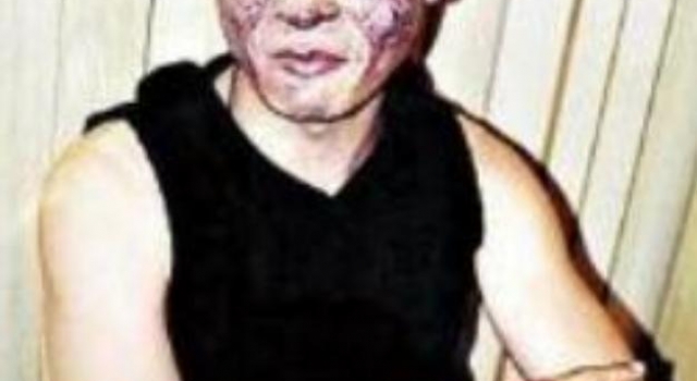 曾被重度烧伤的陈志朋，如今涅槃重生，却被金星吐槽油腻