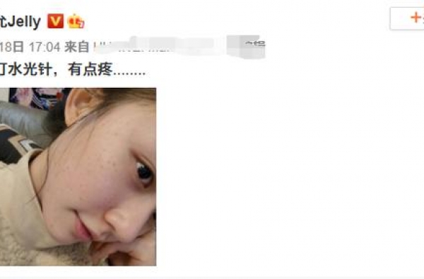 星女郎林允白嫩左脸满是针眼，密密麻麻好吓人，为了变美也太拼了