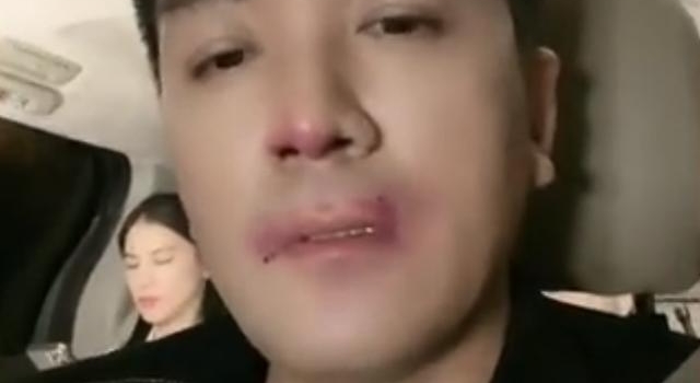 杨子直播出镜鼻青脸肿？和黄圣依坐车前后排，夫妻零交流互不搭理